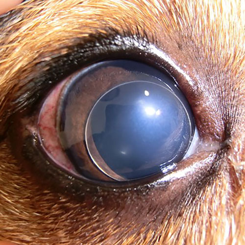 Luxação do cristalino