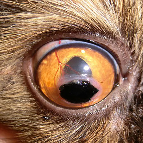 Sequestro de córnea